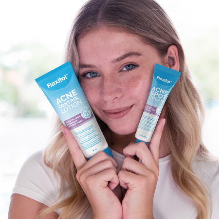 Two Flexitol products held near face including Acne Control Lotion and Acne Spot Cream tubes