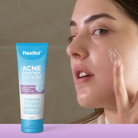 Flexitol Acne Control Lotion tube beside person applying lotion to cheek