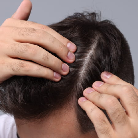 flexitol me thinning hair and hair loss condition page faq image